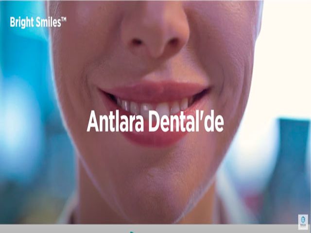 Antlara Dental'de Gülüşünüzü Yenilemenin Tam Zamanı!